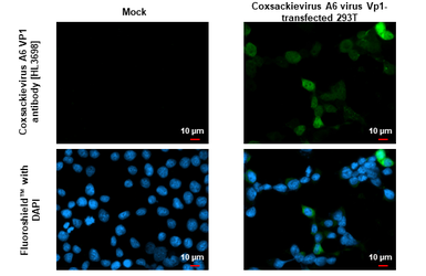 Anti-Coxsackievirus A6 VP1 antibody [HL3698] used in Immunocytochemistry/ Immunofluorescence (ICC/IF). GTX641870